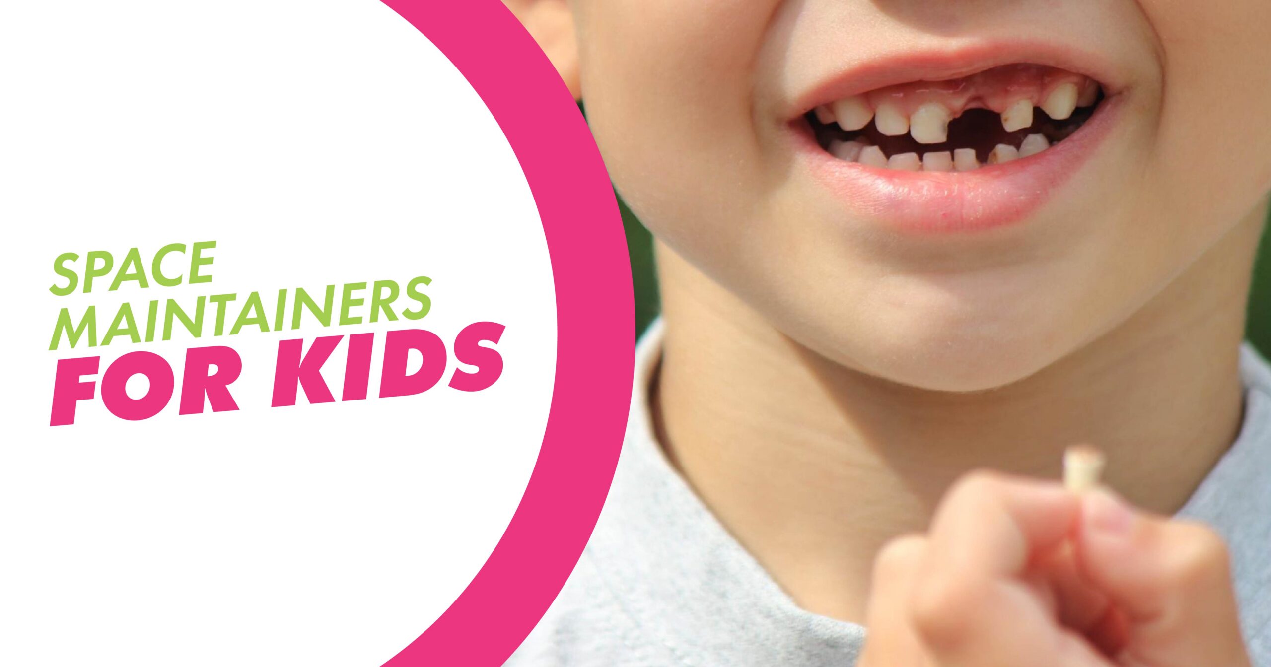A child holding his front tooth that fell out with a text overlay that says Space Maintainers for Kids