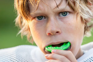 Mouthguards for your Child