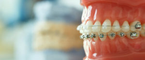 Orthodontics