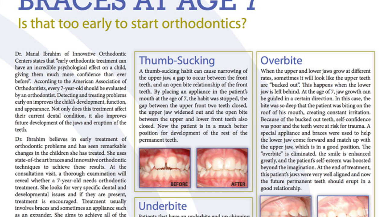The Benefits of Early Orthodontic Intervention