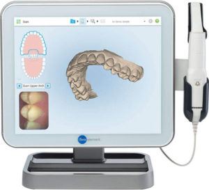 itero-scanner-pediatric-scanner