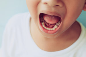 Nutrition for Cavity Prevention